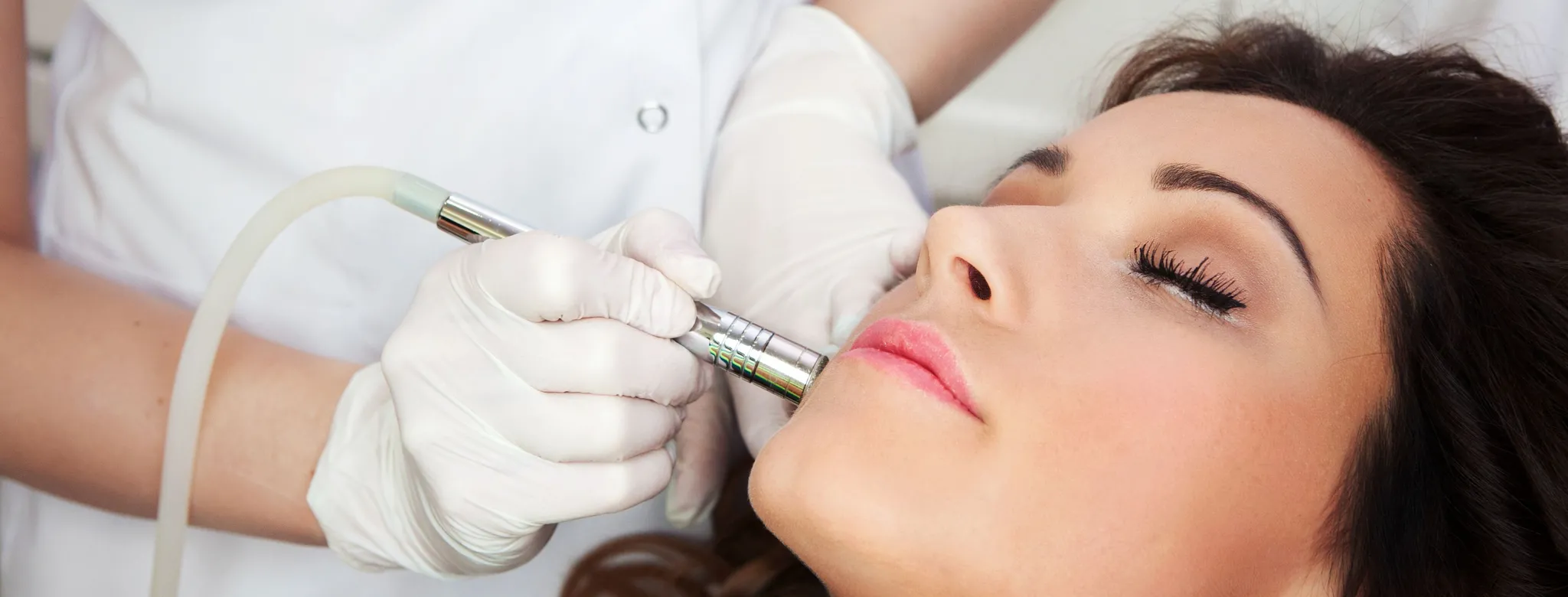 Woman receives microneedling at medical spa
