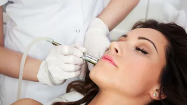 Woman receives microneedling at medical spa